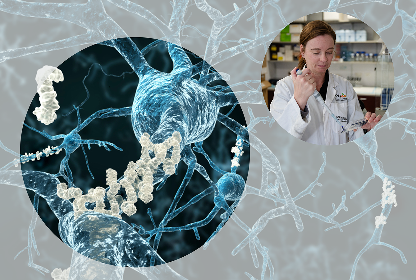Anonymous gift bolsters Alzheimer’s research