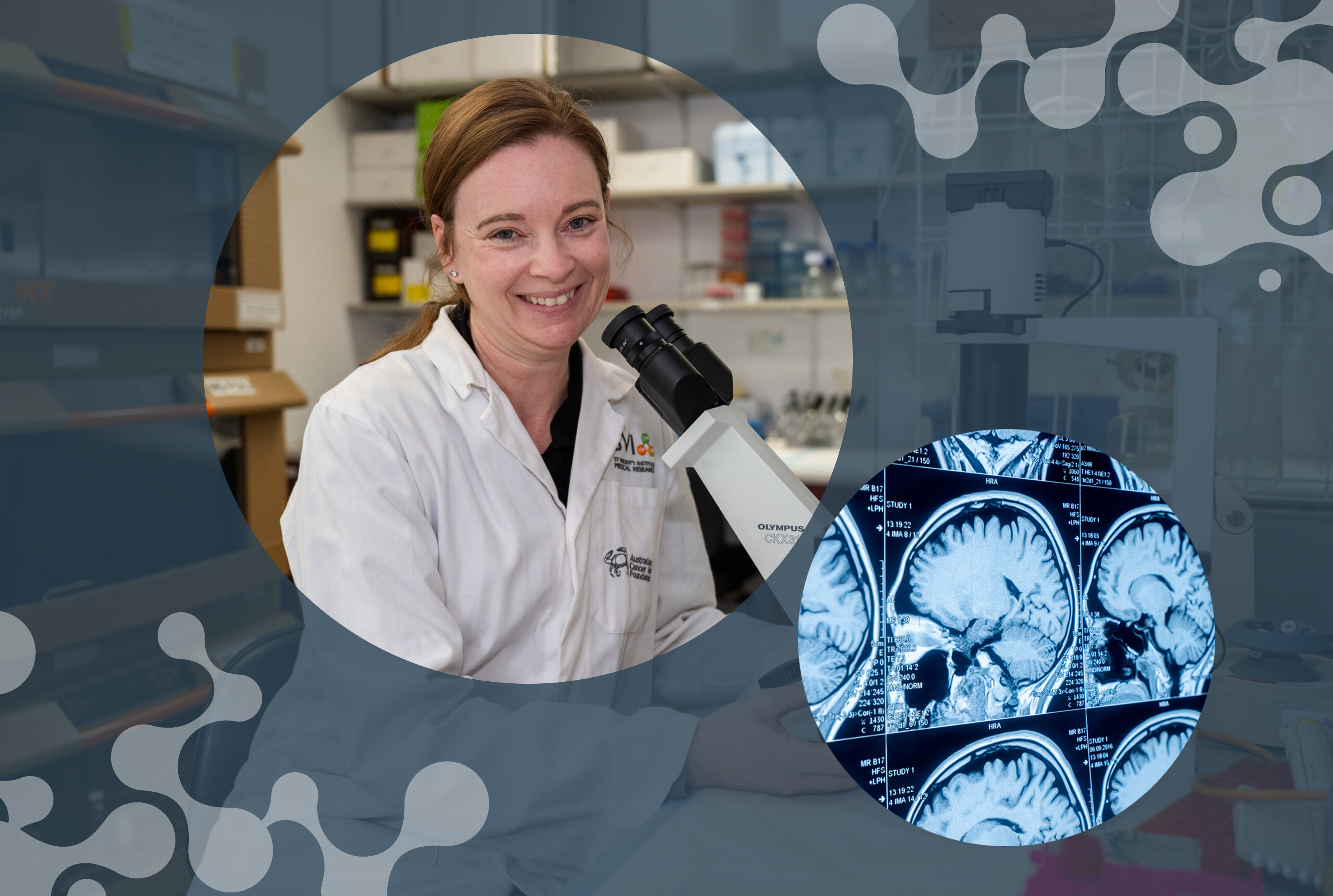 New grant helps pave the way for Alzheimer’s research